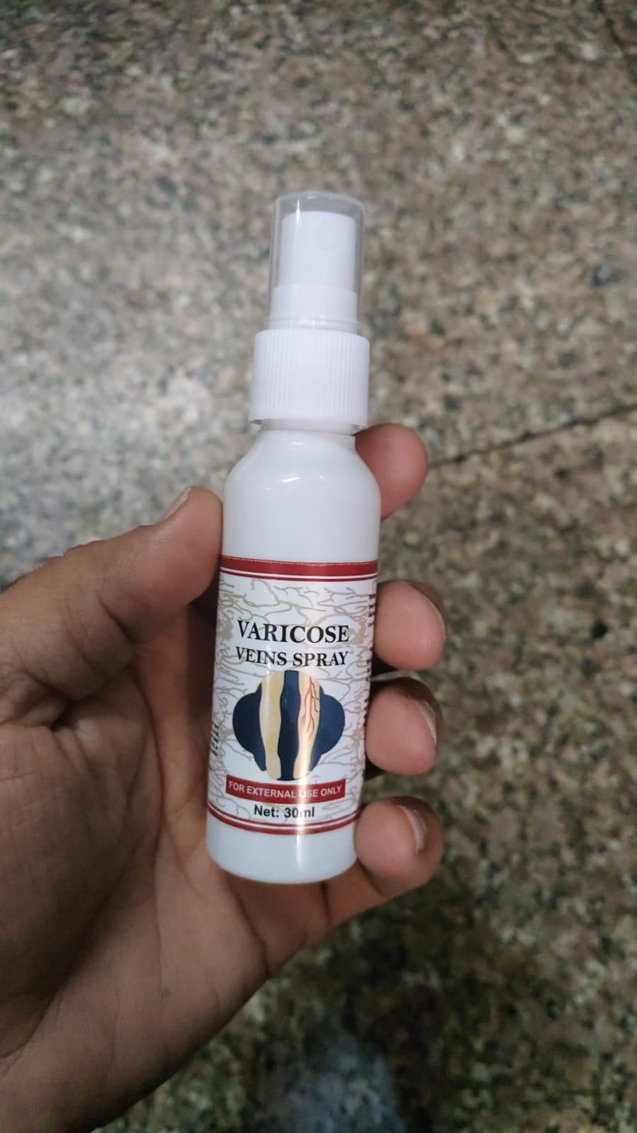 Varicose Veins Healing Spray