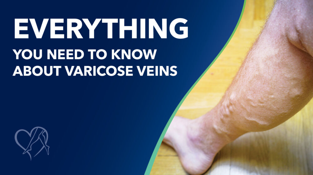 Load video: What is Varicose Veins and how does it arise